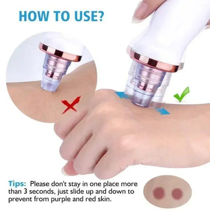 Vacuum Blackhead Remover