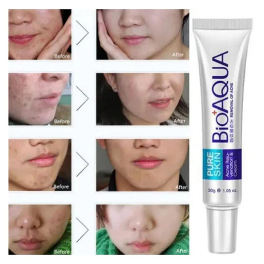 Acne Scar Removal Rejuvenation Cream