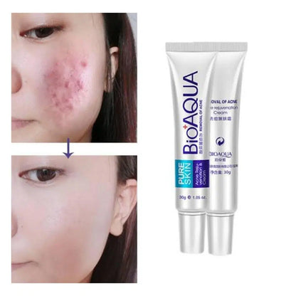 Acne Scar Removal Rejuvenation Cream