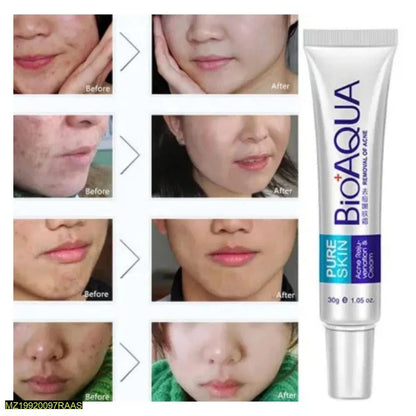 Acne Scar Removal Rejuvenation Cream